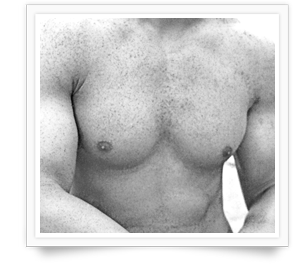 Dr Mark Waker - Binghamton Gynecomastia Cosmetic Surgeon